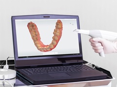 A digital impression scanner