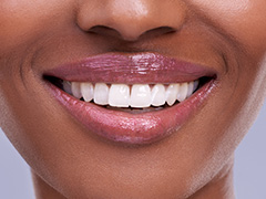 Closeup of beautiful health smile thanks to dental services in Torrance