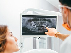 Dentist and patient looking at digital dental x-rays
