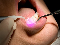 Patient receiving laser treatment