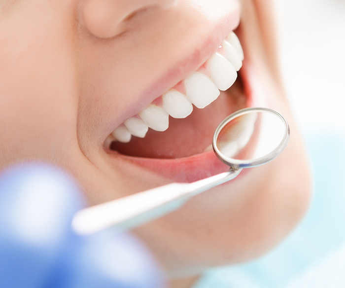 Close up of dental mirror reflecting a smile