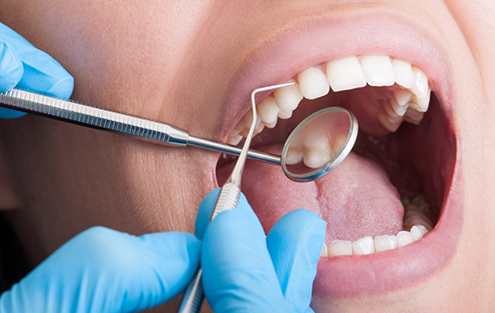 Close up of a patient receiving a dental exam