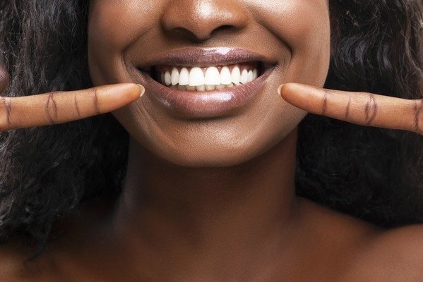 woman smiling and pointing to teeth