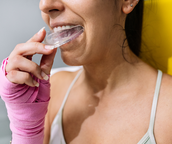 Woman placing an athletic mouthguard over her teeth