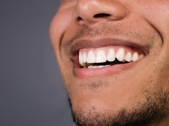 Man's smile after Invisalign treatment for bite alignment