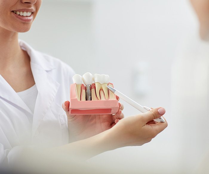 a dentist explaining how bone grafting works