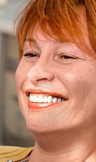 Smiling senior woman after tooth replacement with dental implants