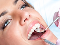 Female patient receiving dental exam