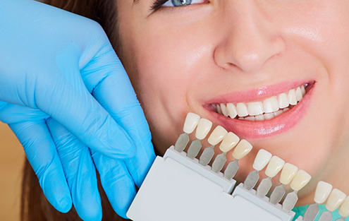 Dentist holding a shade guide in front of a smiling patient