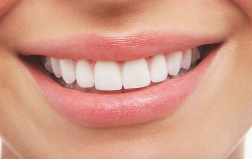 Close up of a smile with flawless teeth