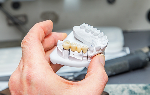 Hand holding a model of a dental bridge