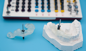 Model of the jaw with surgical guides for dental implant surgery