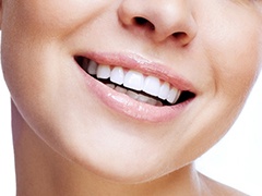 Closeup of flawless healthy smile after dental bonding