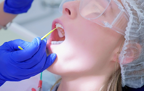Dental patient having fluoride applied to their teeth