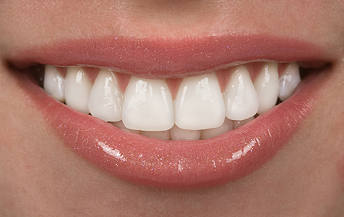 Close up of a flawless smile with white teeth