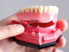implant dentist in Torrance holding a model of an implant denture