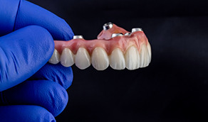 Gloved hand holding an upper denture