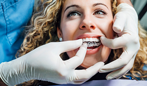 Dentist placing Invisalign over a patients teeth