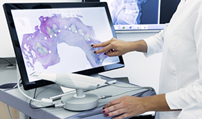 Dentist looking at a screen with digital impressions of teeth