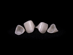 Four ceramic dental crowns as examples of metal-free restorations in Torrance, CA