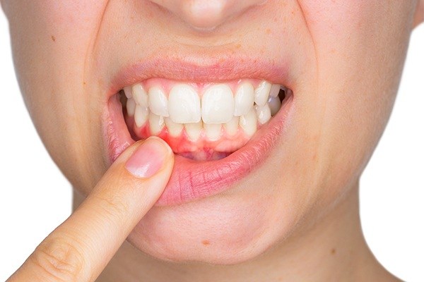 Closeup smile of dental patient