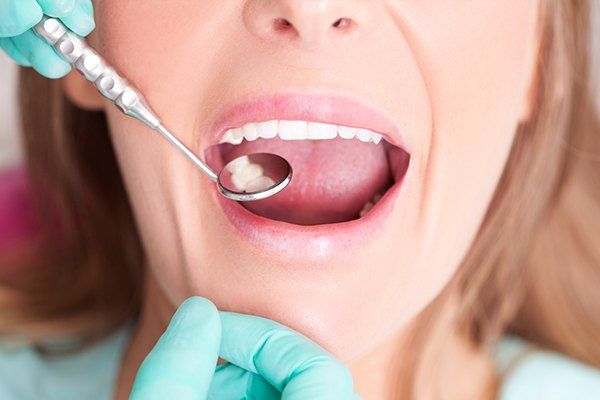 Patient receiving dental checkup