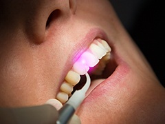Patient receiving laser gum disease treatment