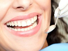 Closeup of smile during preventive dentistry exam