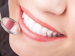Closeup of healthy smile with dental sealants