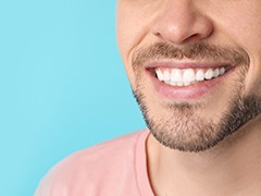 Closeup of man's smile after cosmetic dentistry