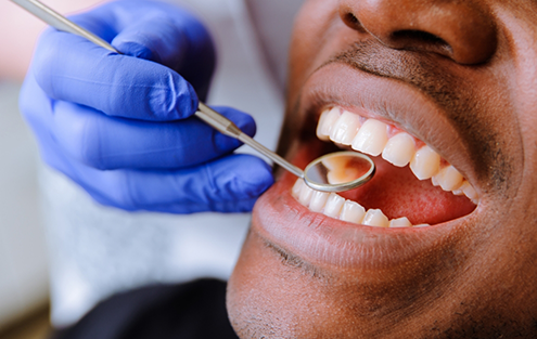 Dentist examining a patients teeth