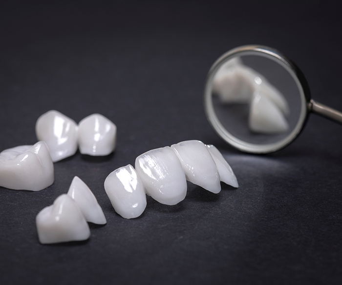 Several veneers in Torrance next to a dental mirror