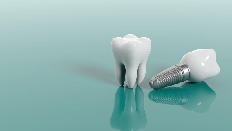 a regular tooth and a dental implant