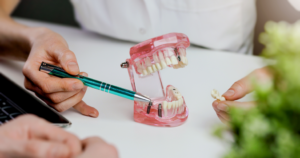 a close-up of a dental implant model