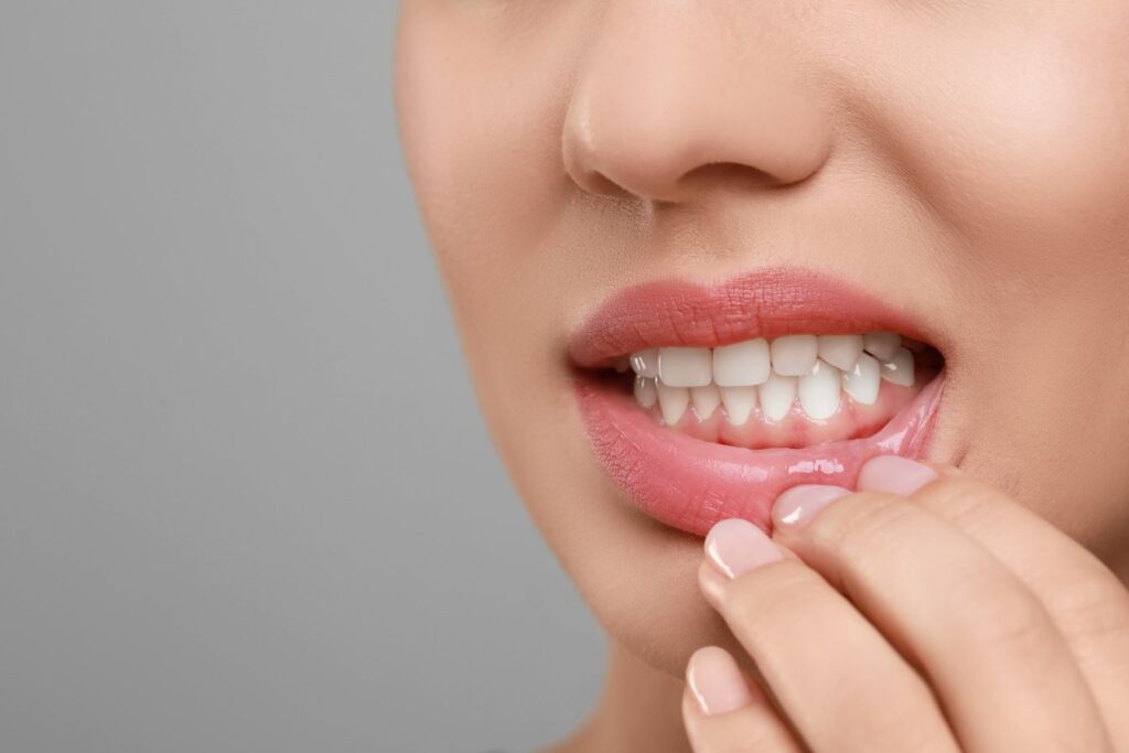 A woman with gum disease